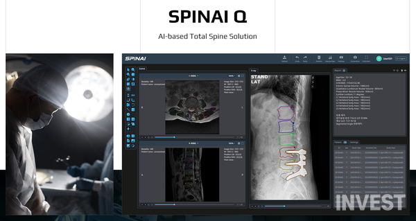 스피나이Q 소프트웨어 (출처: 스피나이 홈페이지 갈무리)