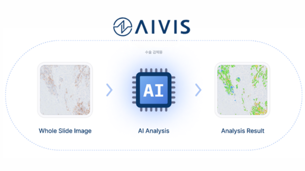 출처 = 에이비스